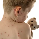 MMR Awareness Campaign