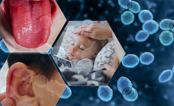 NWLD-composite-Strep-A-infection---symptoms-explained-MH