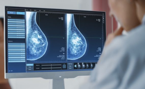 Computer,Screen,In,Hospital,Radiology,Room:,Beautiful,Multiethnic,Adult,Woman